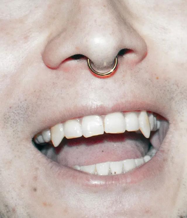 BXGGXXMMX