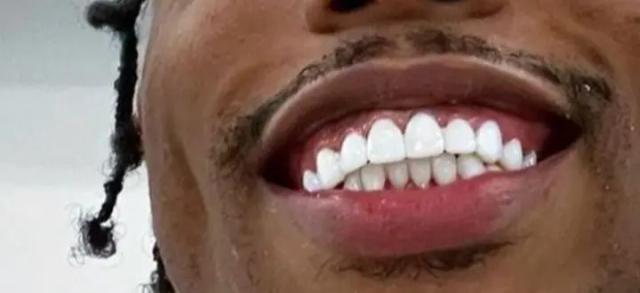 GreatestSmileEver