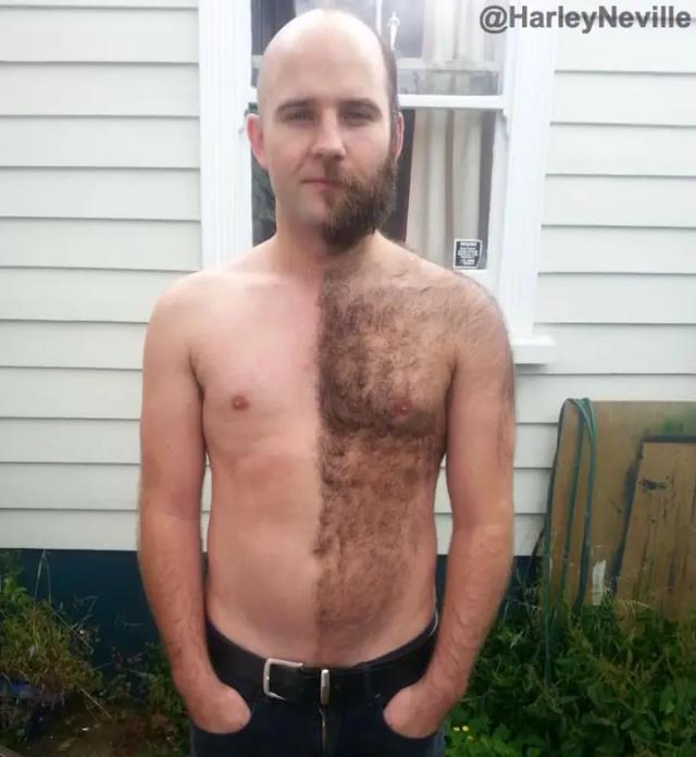 Hairy Navel