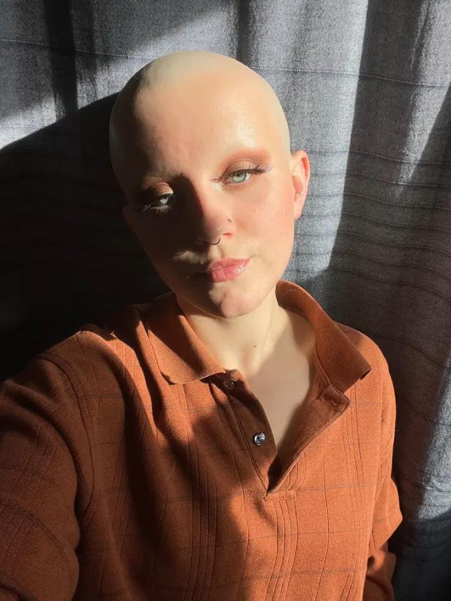 Bald, bold and bothered