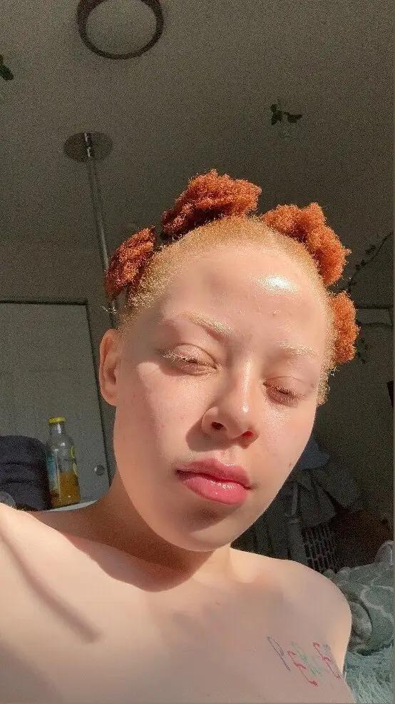 Albino Goddess✨