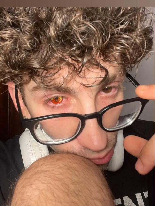 🔞 KAOS